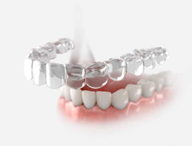 invisalign treatment