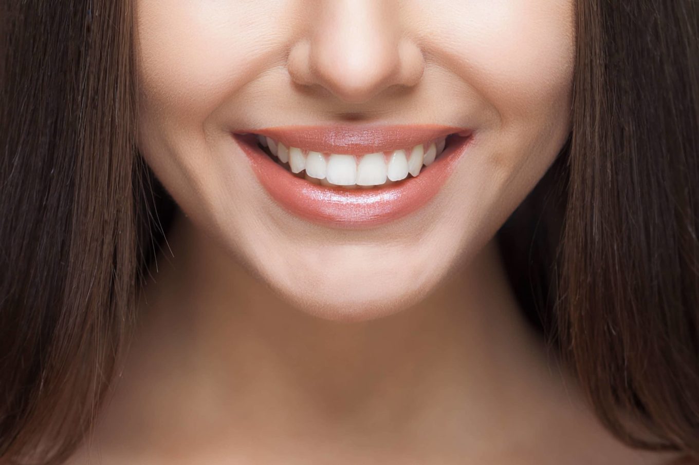 Smile Makeover