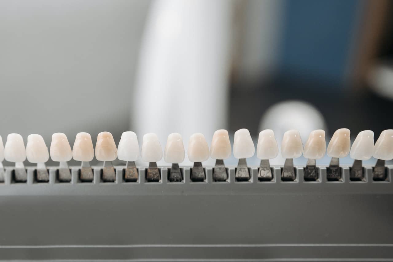 cosmetic teeth bonding