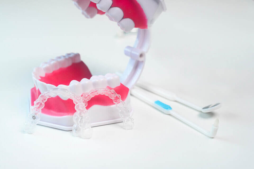 smoke with invisalign